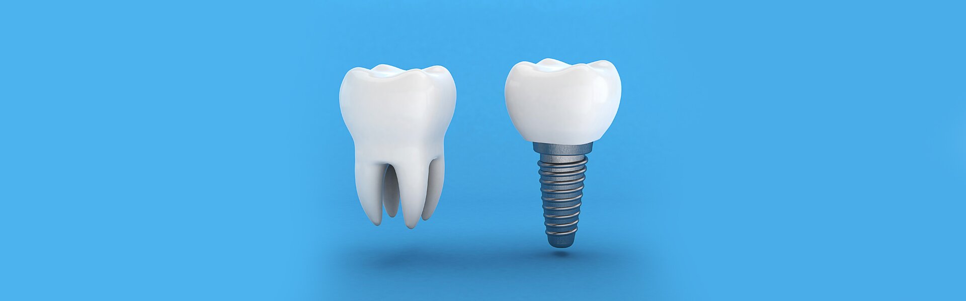 Do Dental Implants Get Cavities?