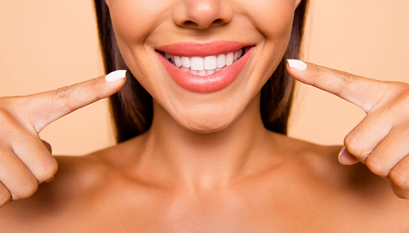 dentist patient model smiling and pointing to her teeth