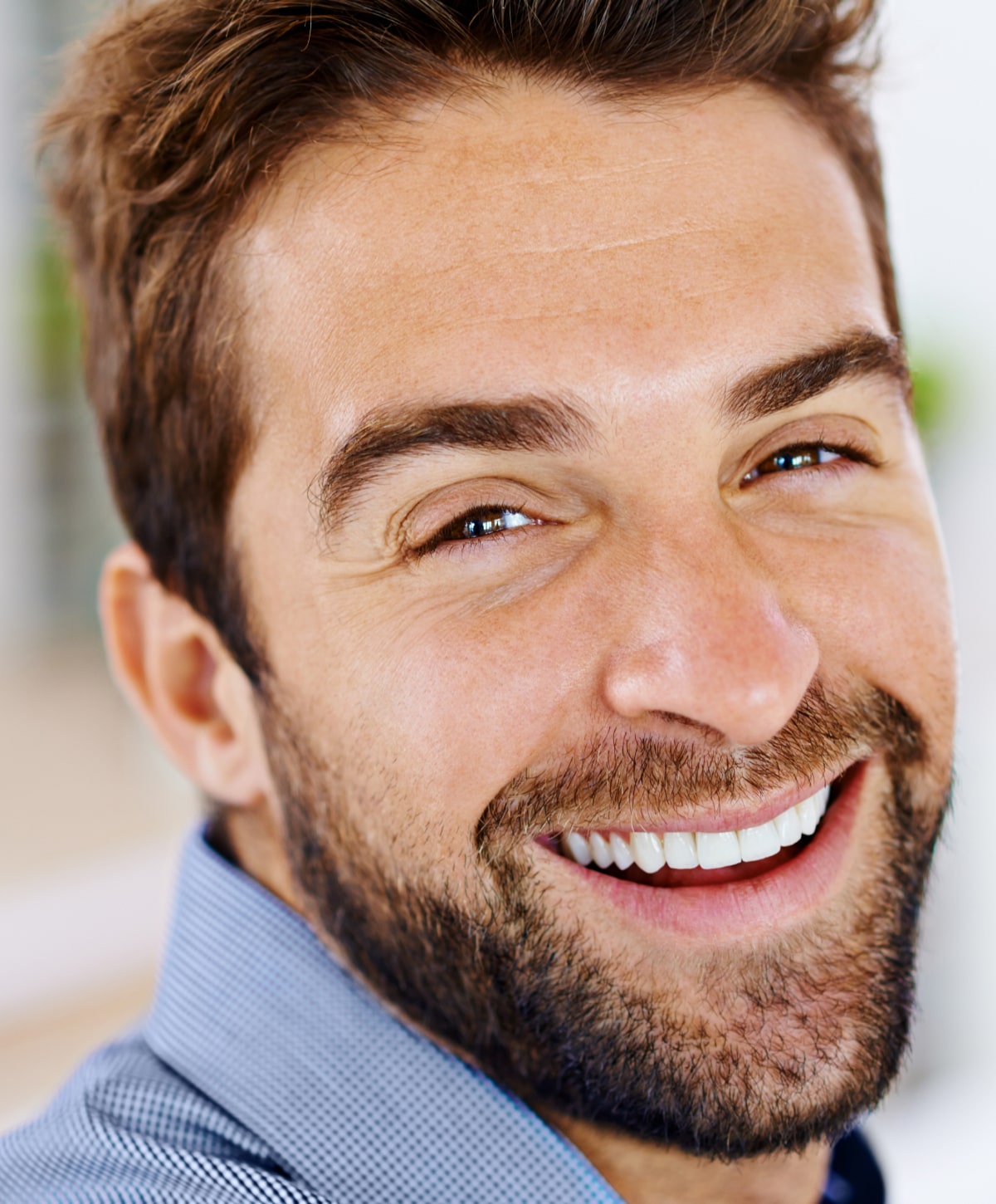 Beverly Hills dental veneers patient model smiling broadly